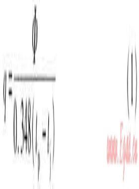 公共建筑廚房通風系統(tǒng)設(shè)計