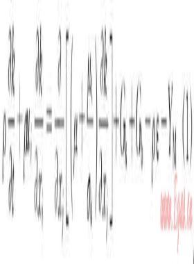 埋地與架空輸氣管道泄漏數值模擬對比分析